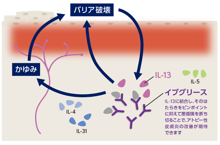 イブグリースとは？（IL-13を抑える注射治療）