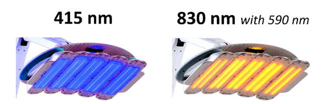 症状に合わせて使い分ける、ヒーライトIIの照射ヘッド(590/830nm, 415nm)