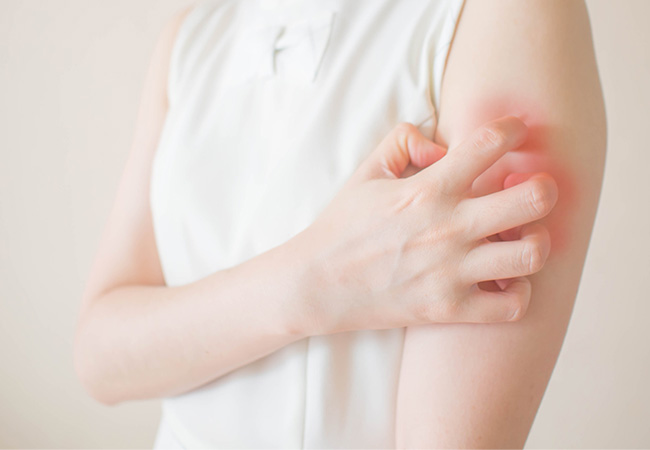 その他の疾患（皮膚・毛髪の病気）