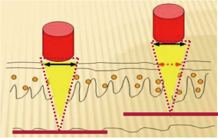 ズームハンドピース(従来)