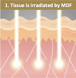 フラクショナル