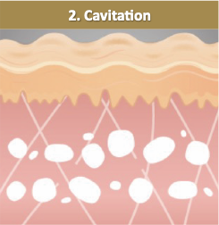 フラクショナル