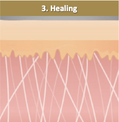 フラクショナル