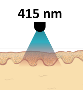 415nm