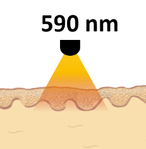 590nm
